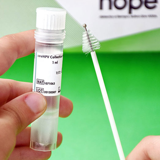 Self-HPV-TESTING-2